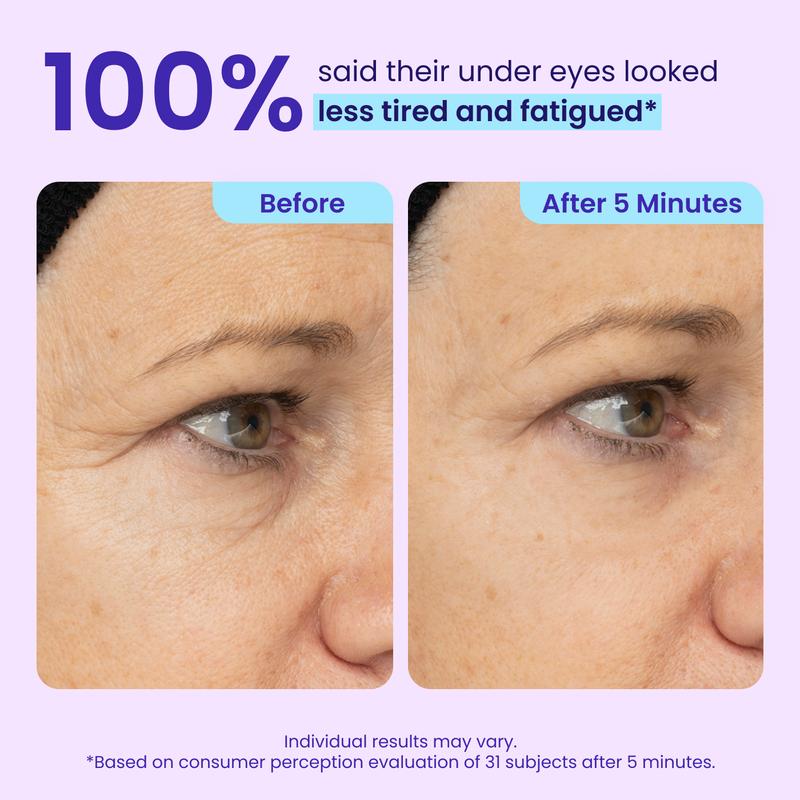 Auria Instant Lift Eye Gel
