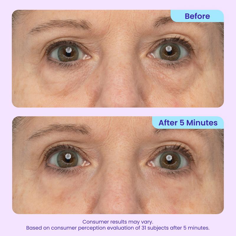 Auria Instant Lift Eye Gel